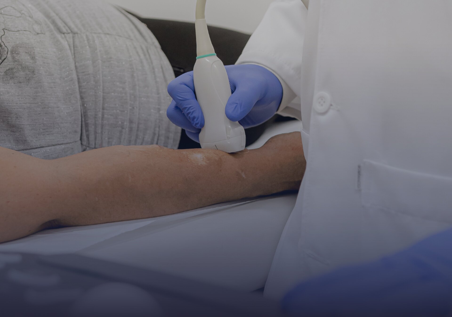 Tratamento de Cateteres e Acessos para Hemodiálise na Clínica Endovascular São Paulo
