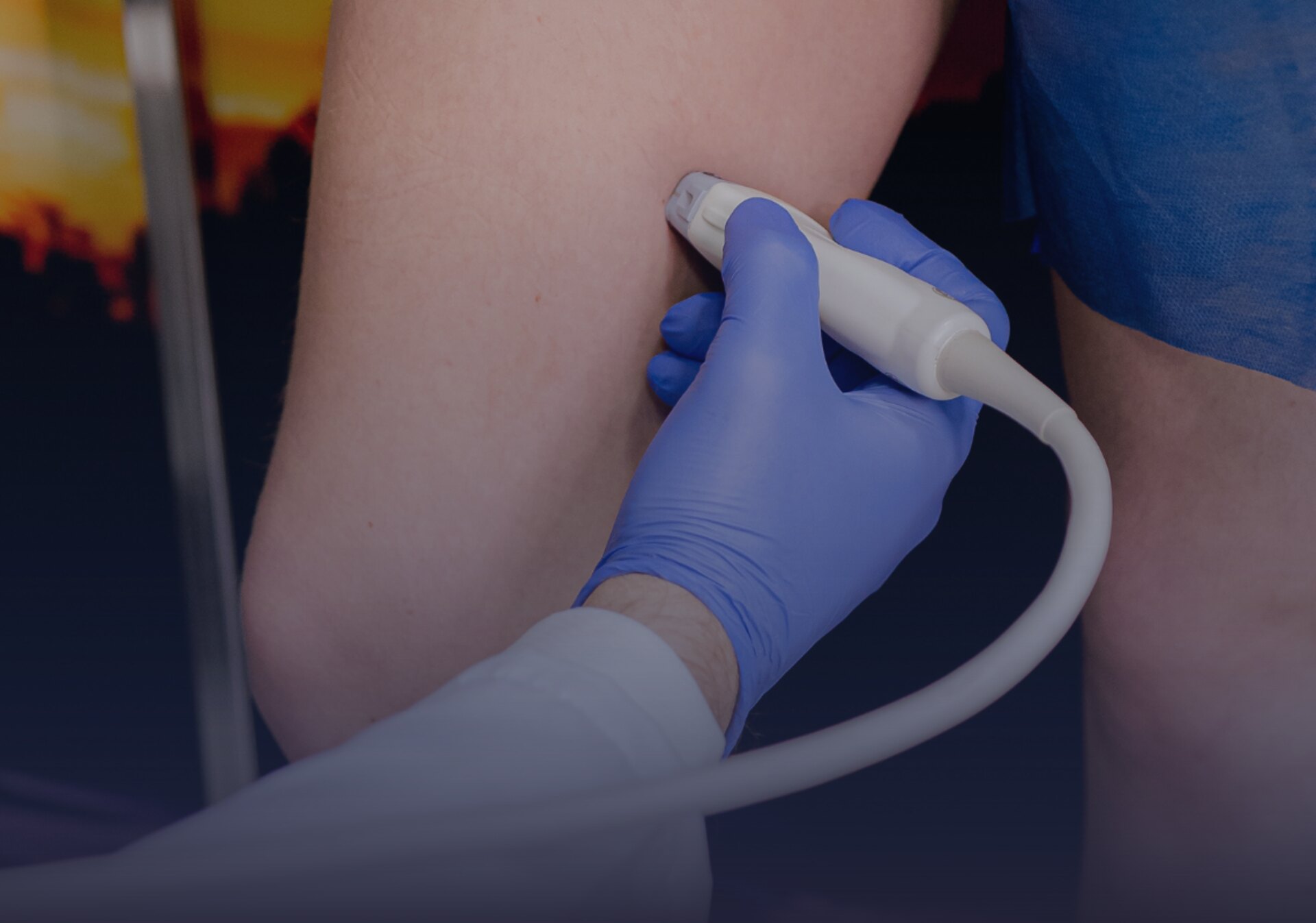 Tratamento de Doença Arterial Periférica na Clínica Endovascular São Paulo